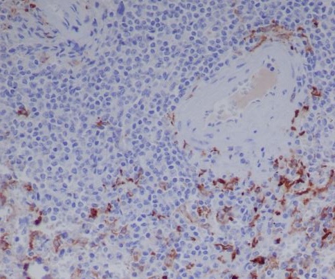 Rabbit Polyclonal Antibody to Human IgG