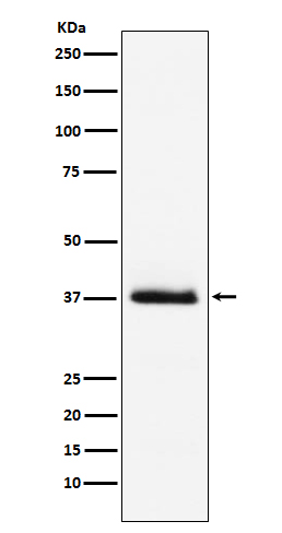 Parathyroid Hormone