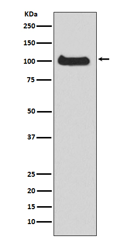 PKD1