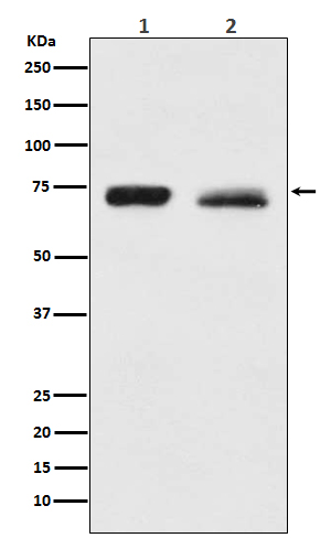 NF2
