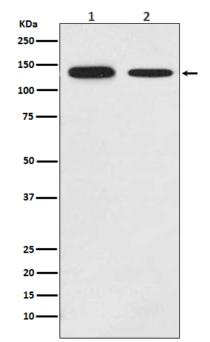 Growth Hormone Receptor