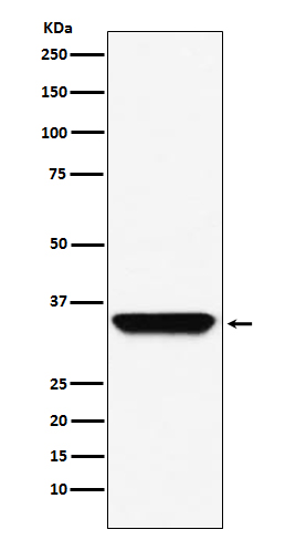 Adenosine A1 Receptor