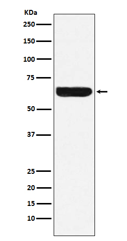 Placental Alkaline Phosphatase