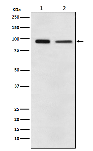 Elongation factor 2