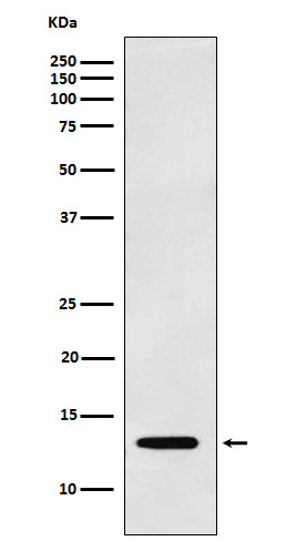 Galectin 1