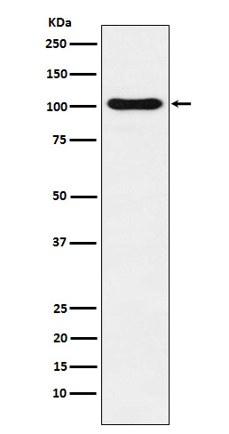 DNA Ligase IV