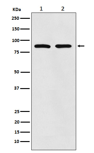Thrombopoietin Receptor