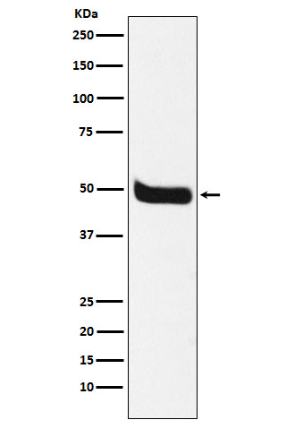 Neurokinin 1 Receptor