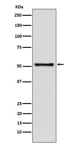 DNA Nucleotidylexotransferase