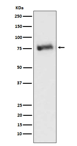GRK3