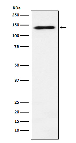 RNA Helicase A