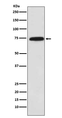 Cytochrome P450 Reductase