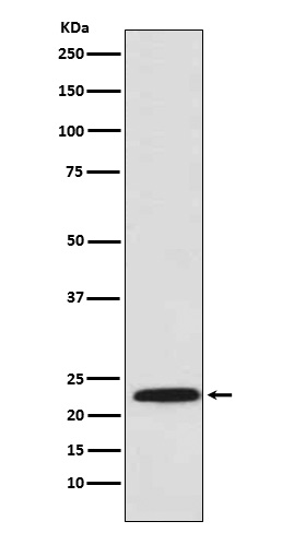 Proteasome beta 8