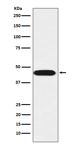 LIS1