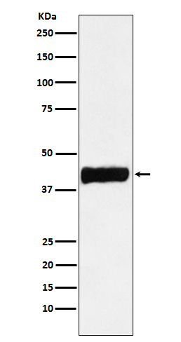 Creatine Kinase B type