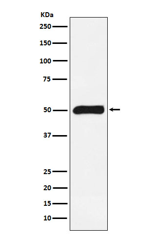 FKBP51