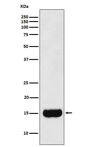 Prostate Secretory Protein