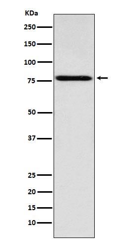 Coilin