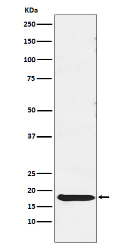 Thyrotropin Subunit beta