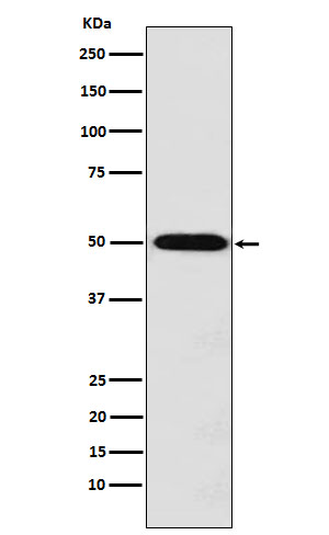 Monocarboxylic Acid Transporter 1