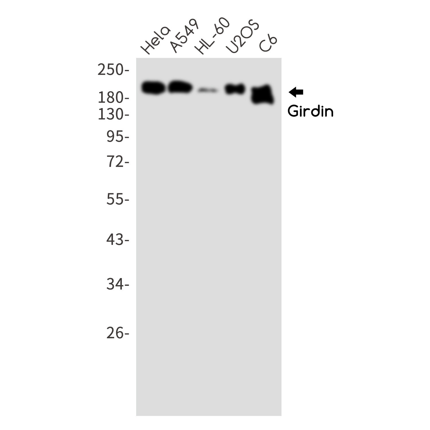 Rabbit Monoclonal Antibody to GIV 