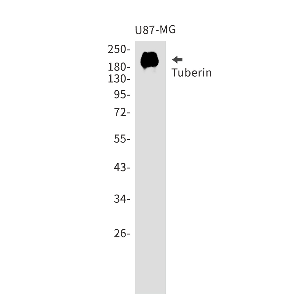 Tuberin