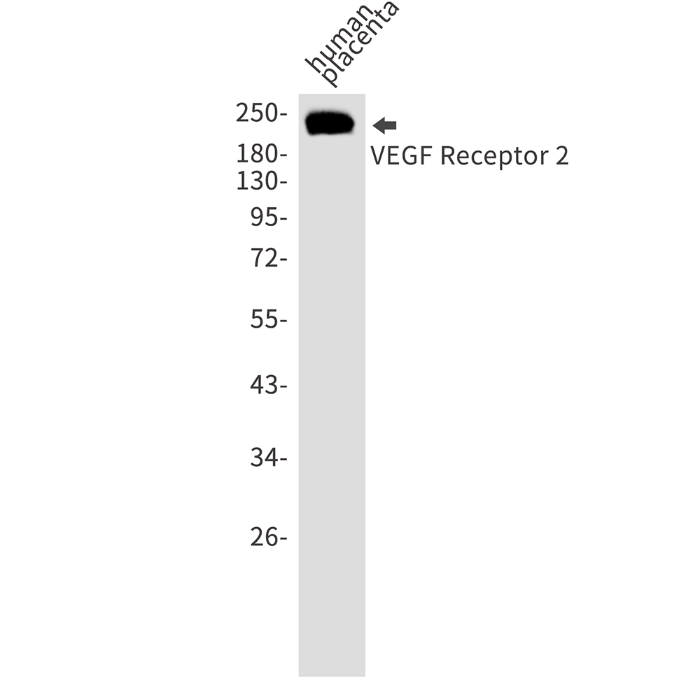 VEGF Receptor 2