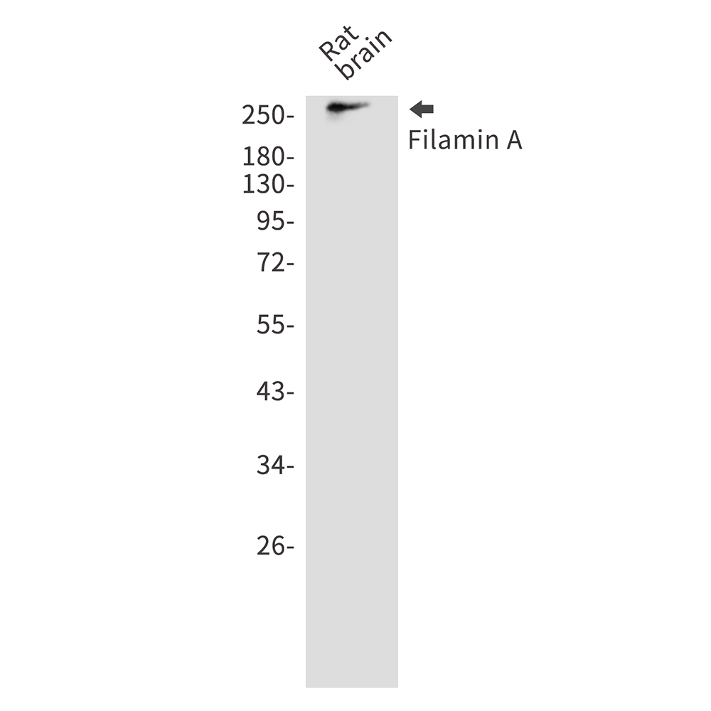 Filamin A
