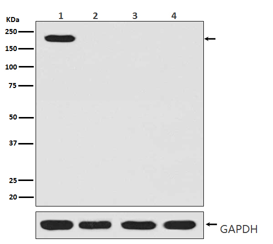CRISPR Cas9 SP