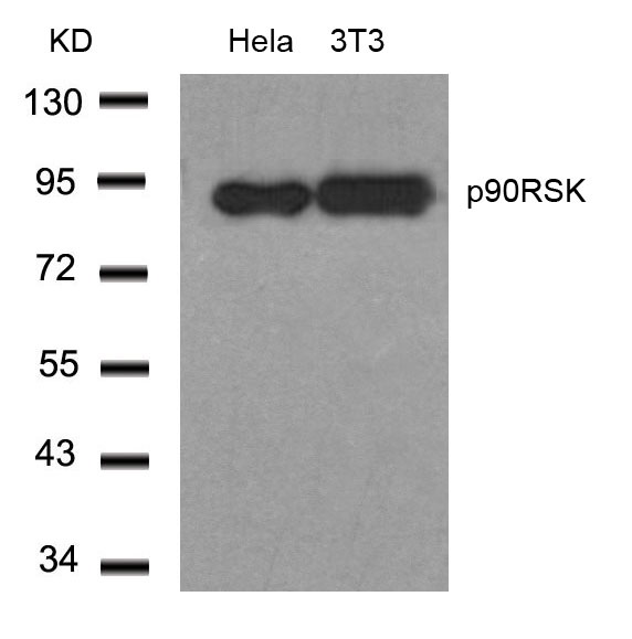 RSK1 p90