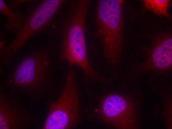 Rabbit Polyclonal Antibody to RSK1 p90