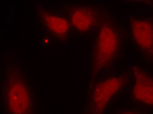 Rabbit Polyclonal Antibody to CDC25C