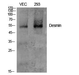 Desmin