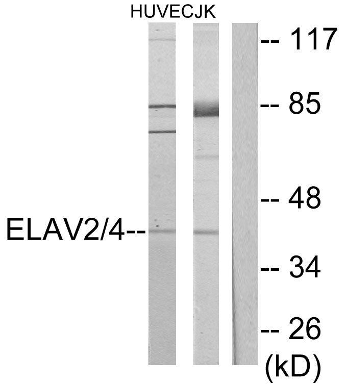 Rabbit Polyclonal Antibody to HuB/HuD