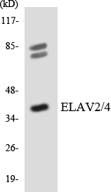 Rabbit Polyclonal Antibody to HuB/HuD