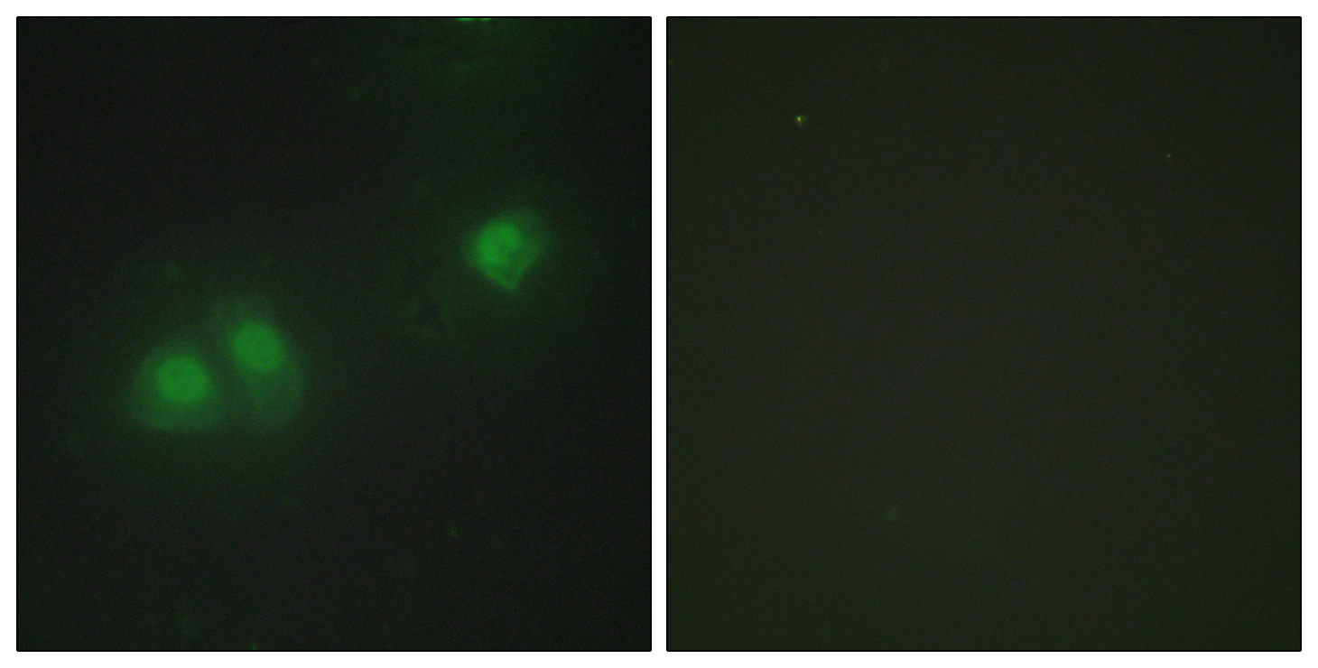 Rabbit Polyclonal Antibody to HuB/HuD