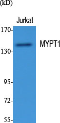 Myosin Phosphatase