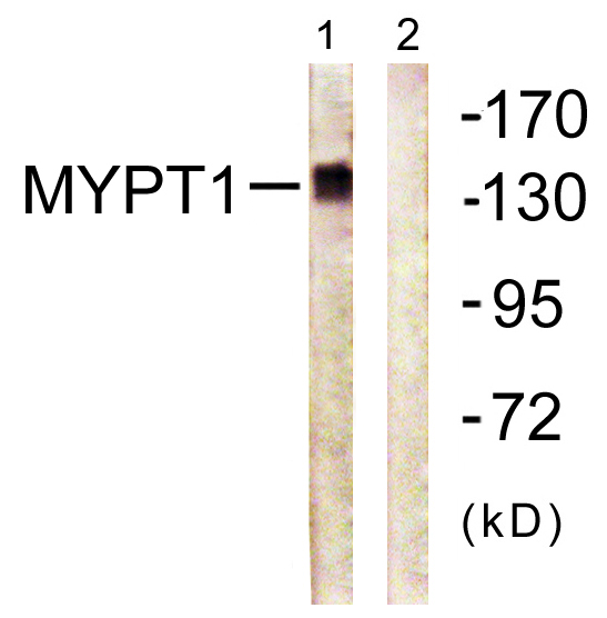 Rabbit Polyclonal Antibody to Myosin Phosphatase