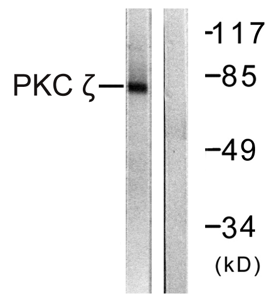Rabbit Polyclonal Antibody to PKC zeta