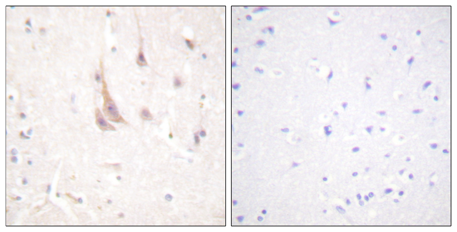Rabbit Polyclonal Antibody to PKC zeta