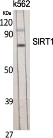 SIRT1
