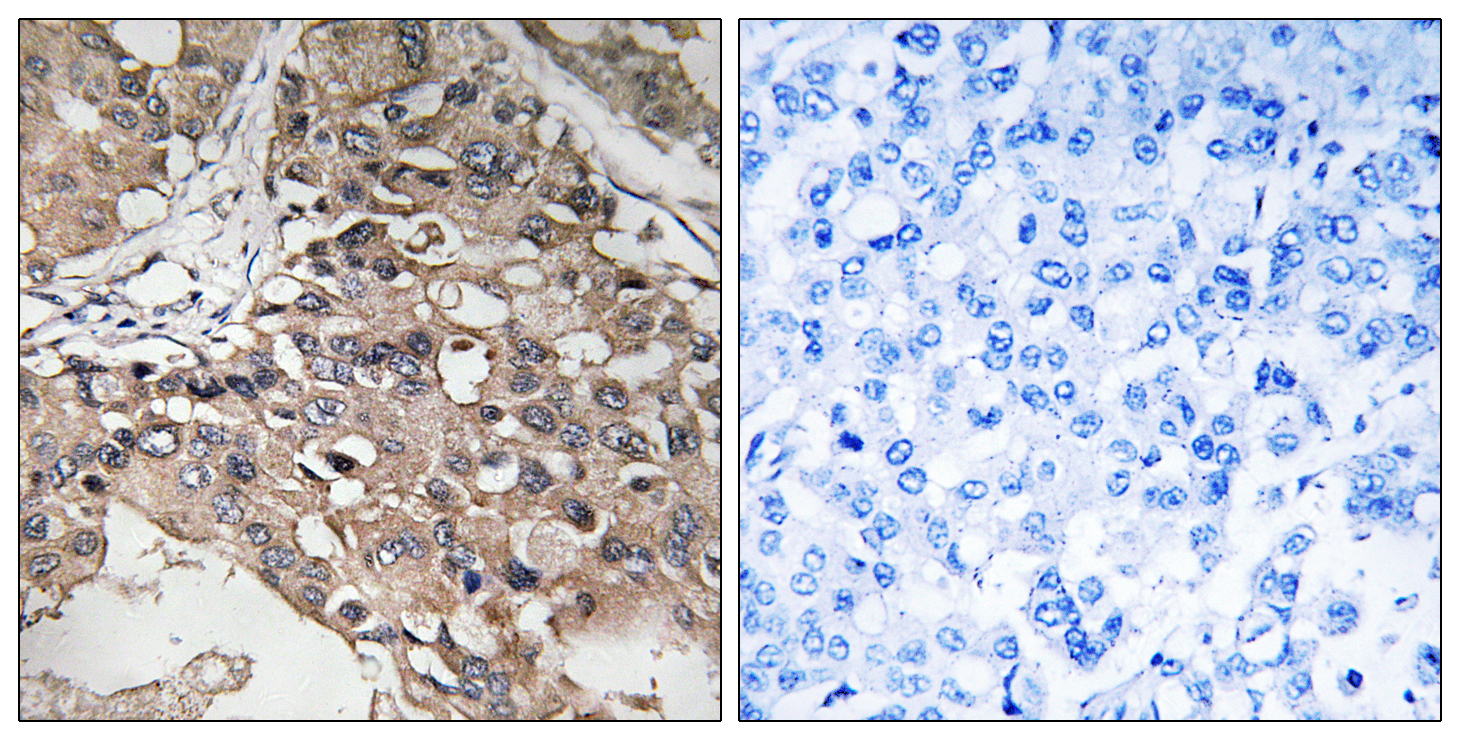 Rabbit Polyclonal Antibody to TAK1