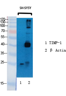 Metalloproteinase Inhibitor 1