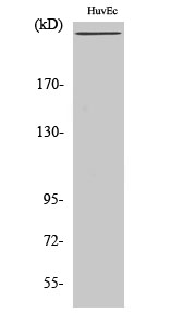 Factor VIII