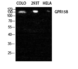 GPR158