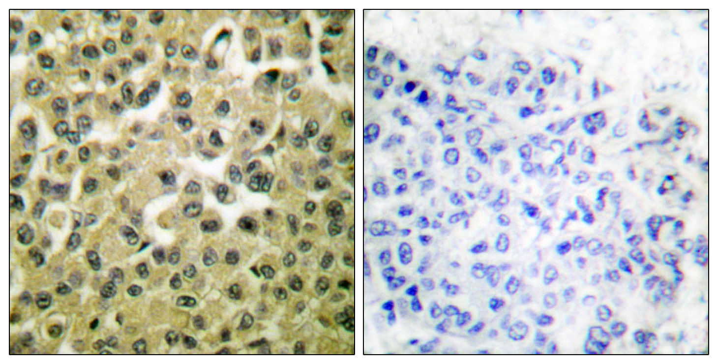 Rabbit Polyclonal Antibody to MCL1