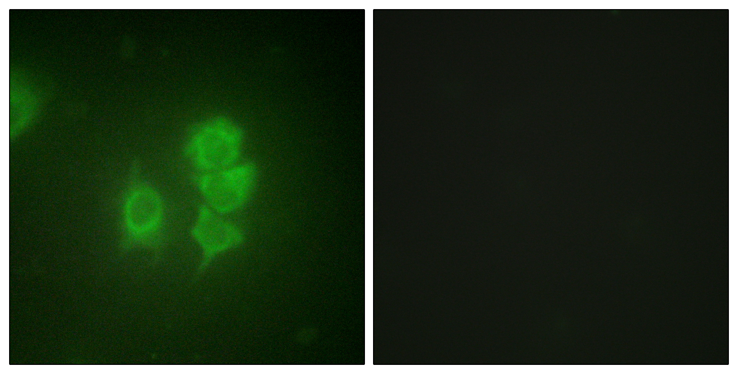 Rabbit Polyclonal Antibody to MSK1