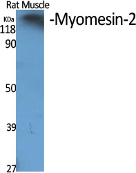 Myomesin 2