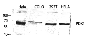 Rabbit Polyclonal Antibody to PDPK1