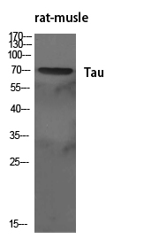 Tau